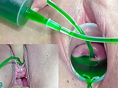 Cervix and Piss Hole Inflation with